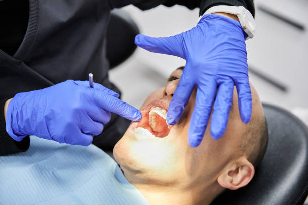 Best Emergency Tooth Extraction in Tracyton, WA